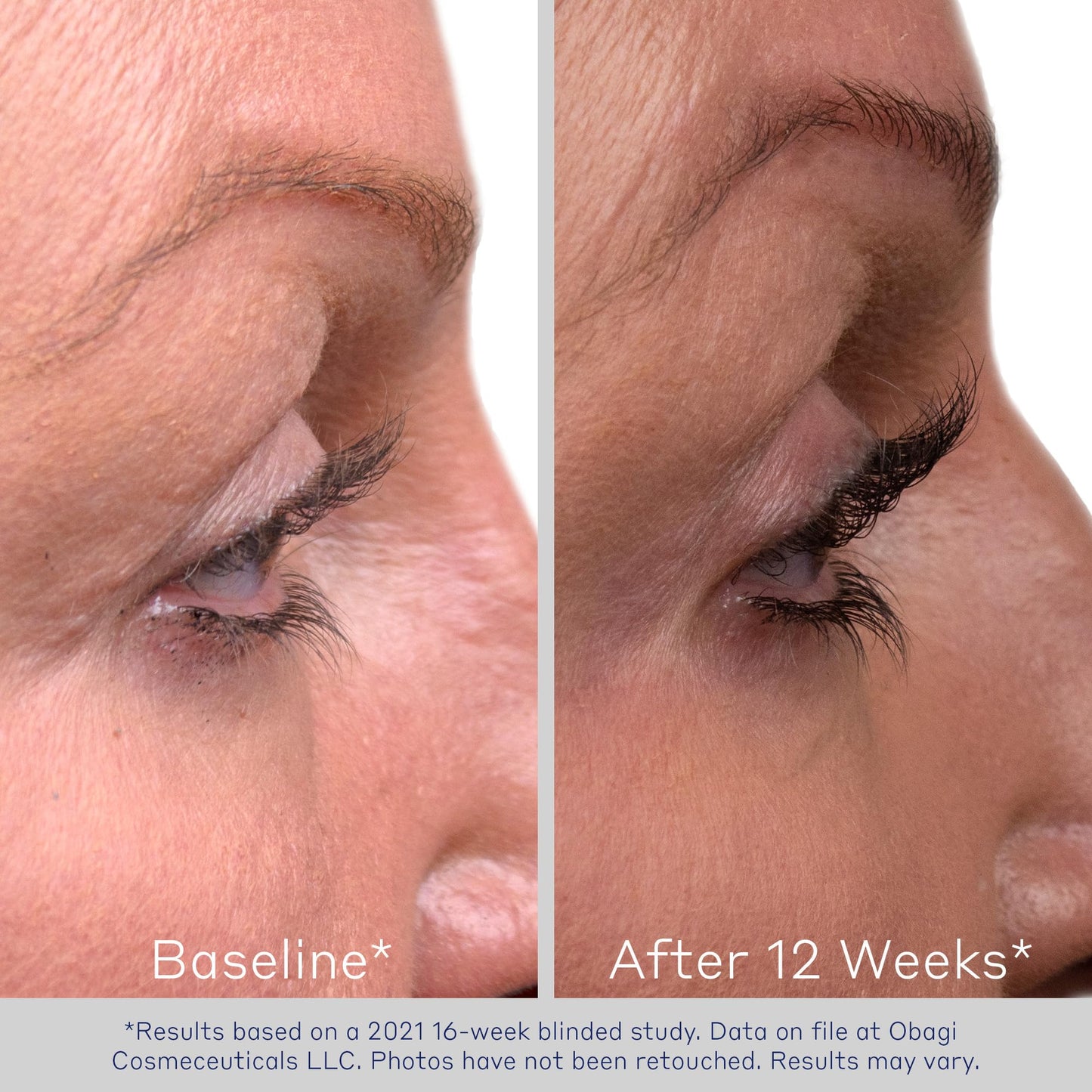 Obagi Nu-Cil Eyelash Enhancing Serum – Nourishing Lash Serum with Biotin for Thicker & More Defined-Looking Lashes – 0.1 oz