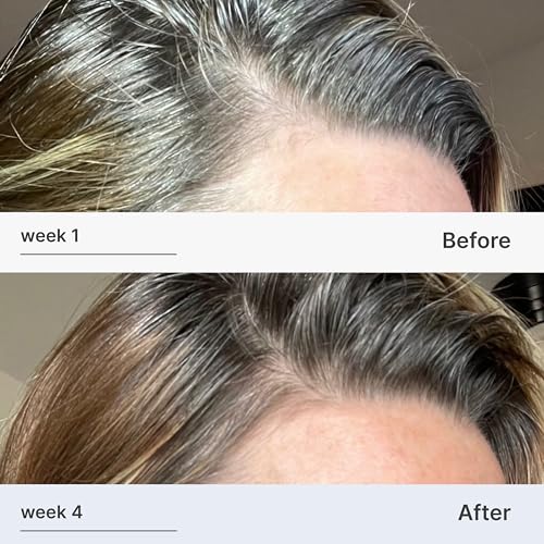 Better Not Younger Fortifying Serum for Thinning and Aging Hair - Promoting Stronger, Thicker Looking Hair Density for Women 40+ Experiencing Hair Loss - 2fl.oz