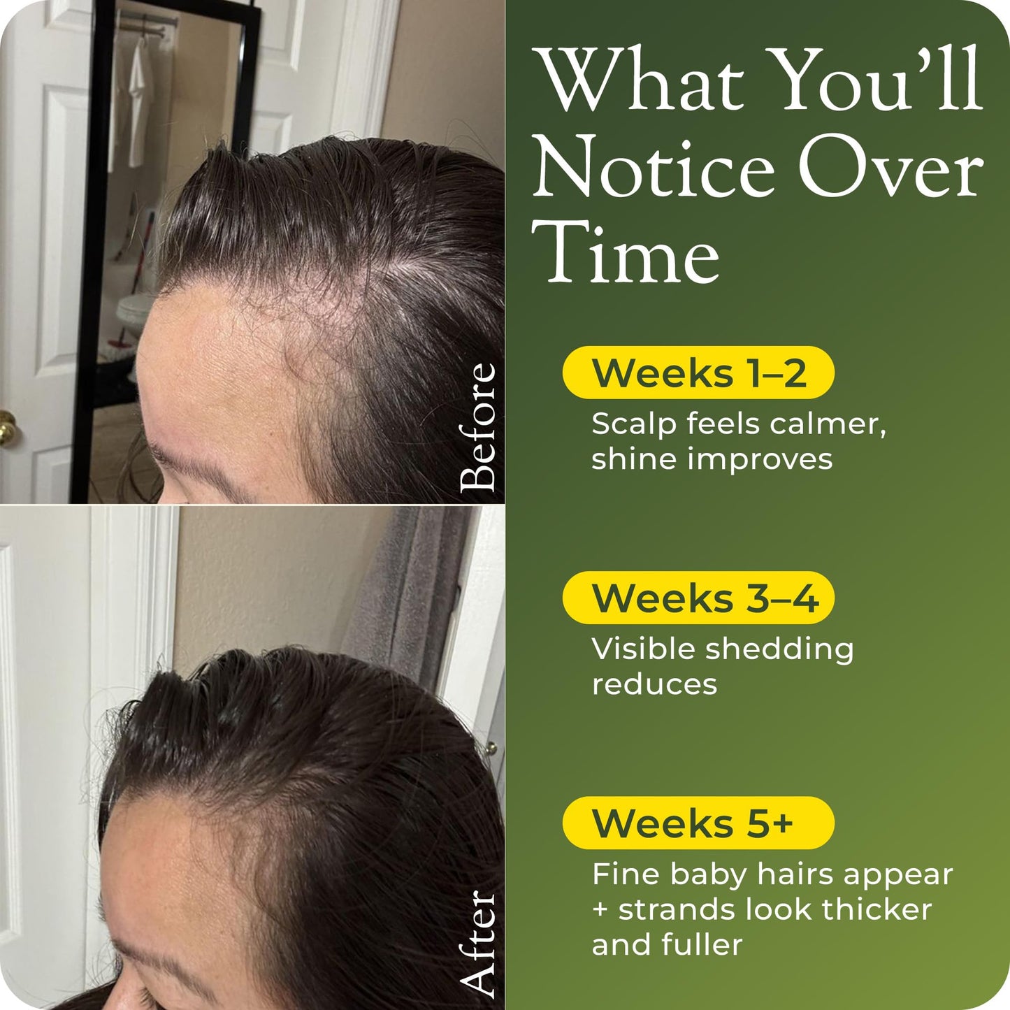 regener8 Hair & Scalp Oil for Women – Essential & Carrier Oil Blend for Hormone-Related Thinning & Loss – Natural Support for Postpartum, Menopause & Chronic Stress